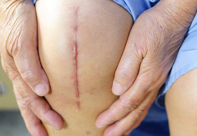 trauma from scars after surgery