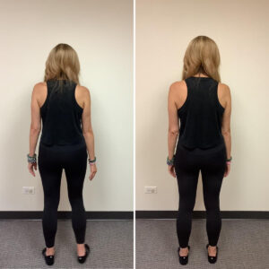 before and after photos of client, Robyn