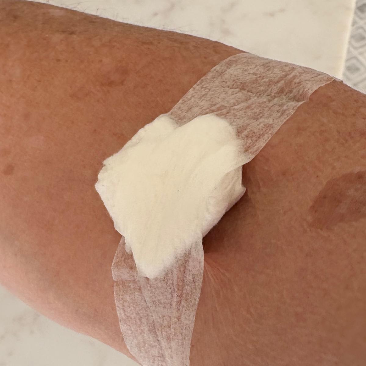 recovering after a blood draw