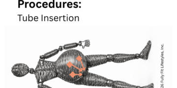 tube insertion