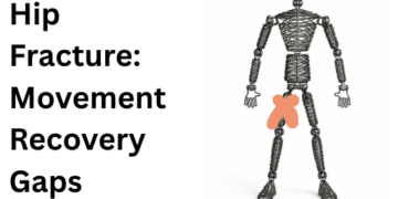movement recovery gaps
