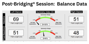 ACL Replacement: Solving Nagging Hip Pain and Balance Concerns