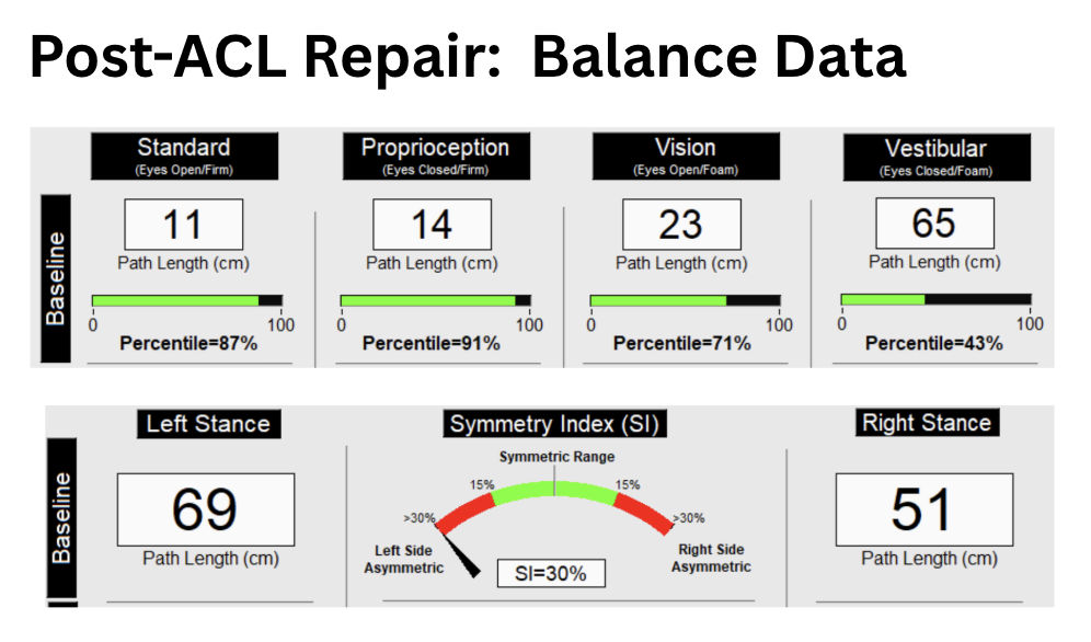 balance dats, ACL repair