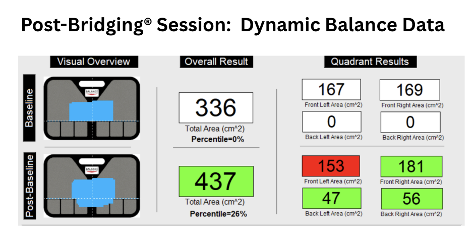 post-bridging-session-dynamic balance-data