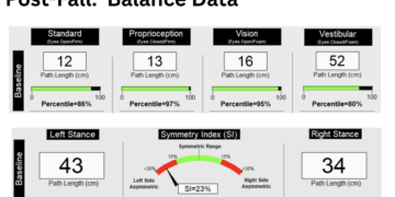 post fall balance data