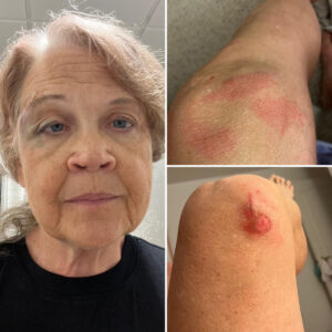 Cara's injuries