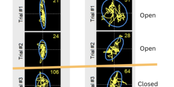 Balance Trace: Eyes open/closed