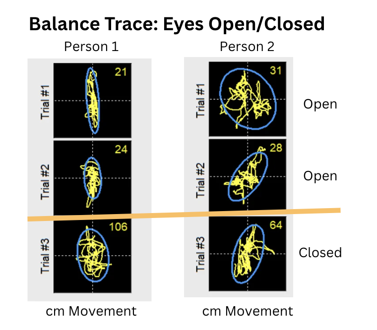 Balance Trace: Eyes open/closed