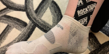 sprained ankle