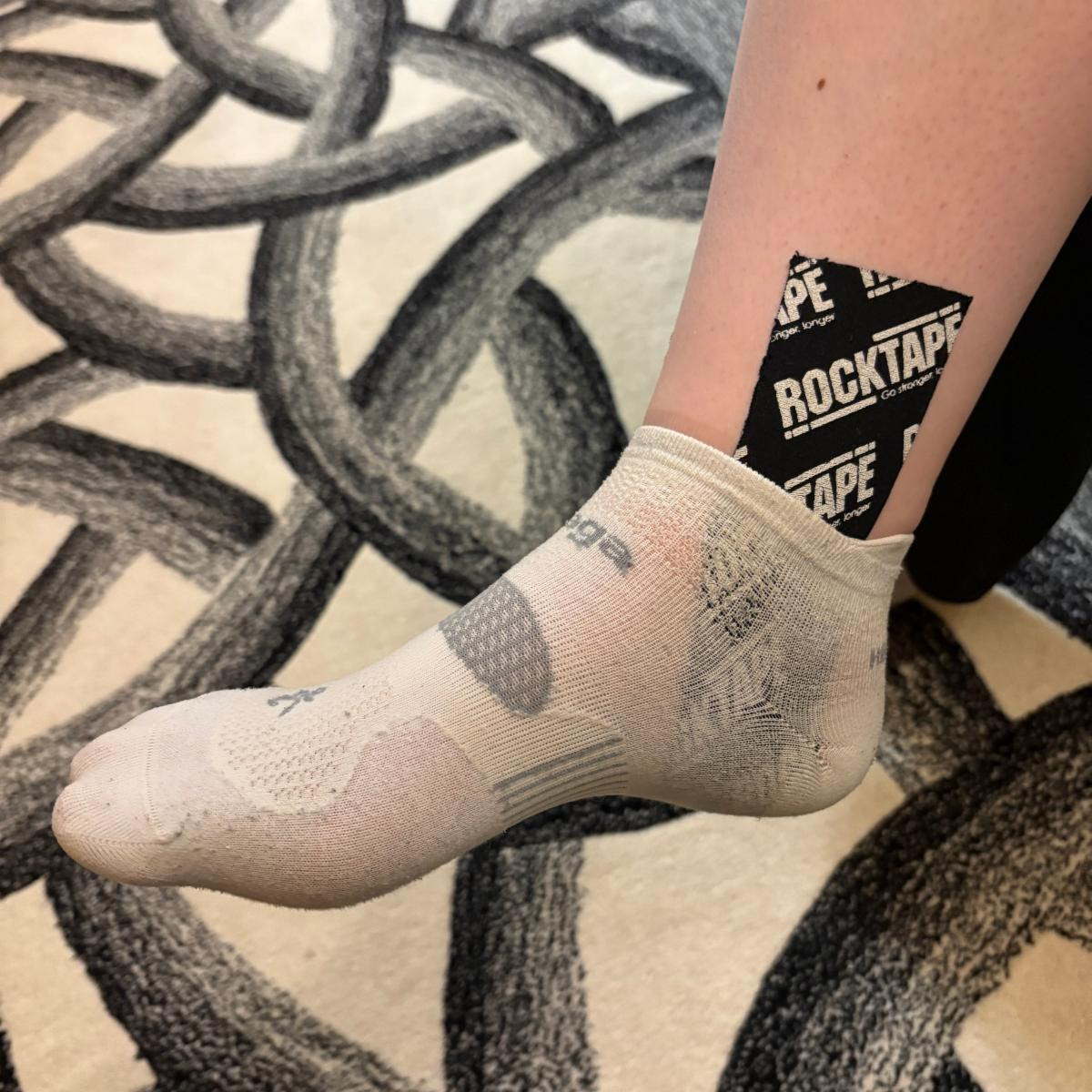 sprained ankle