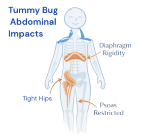tummy bug abdominal impacts